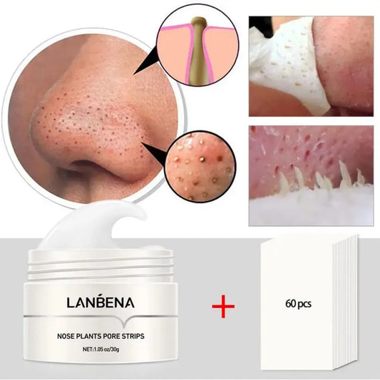 Crema Y Tiras Removedoras De Puntos Negros Para Nariz