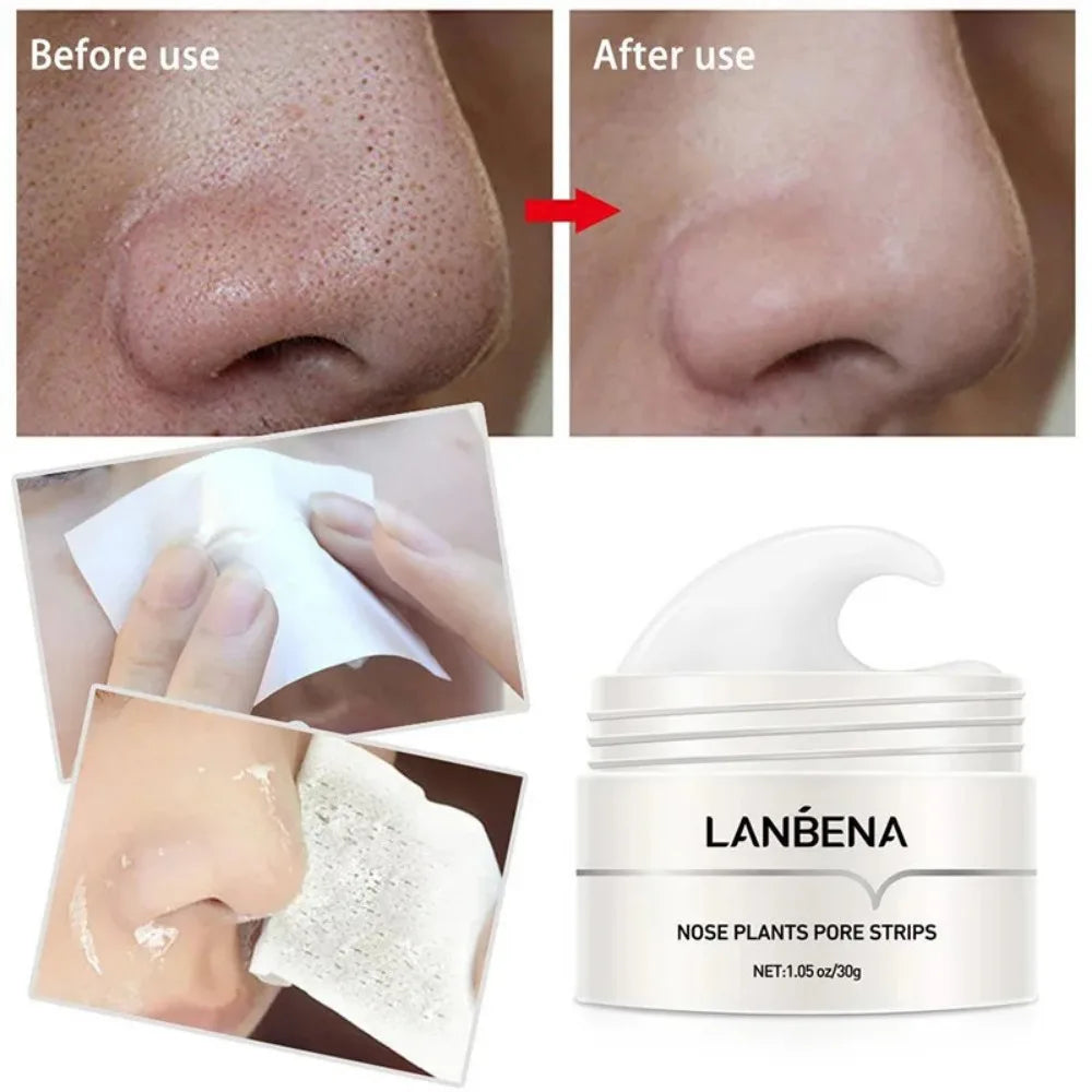 Crema Y Tiras Removedoras De Puntos Negros Para Nariz