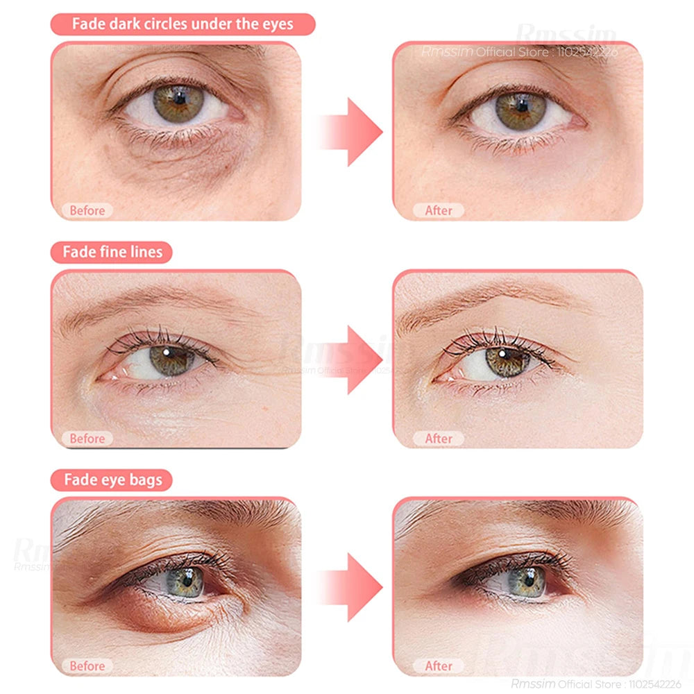 Masajeador De Ojos 3D Con Luz Roja Y EMS