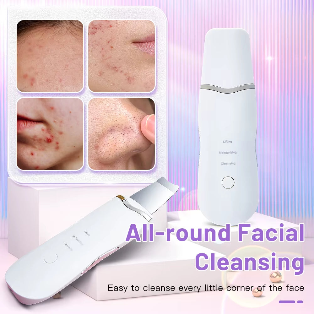 Espátula Ultrasónica De Limpieza Facial